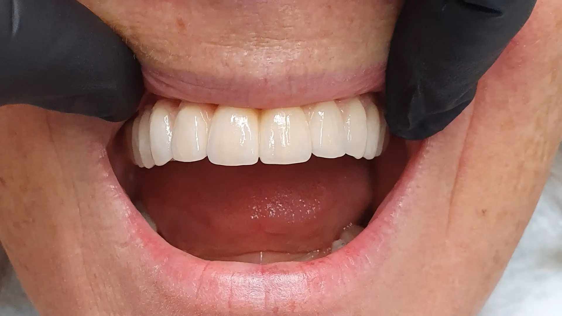 Sourire après soin 2
