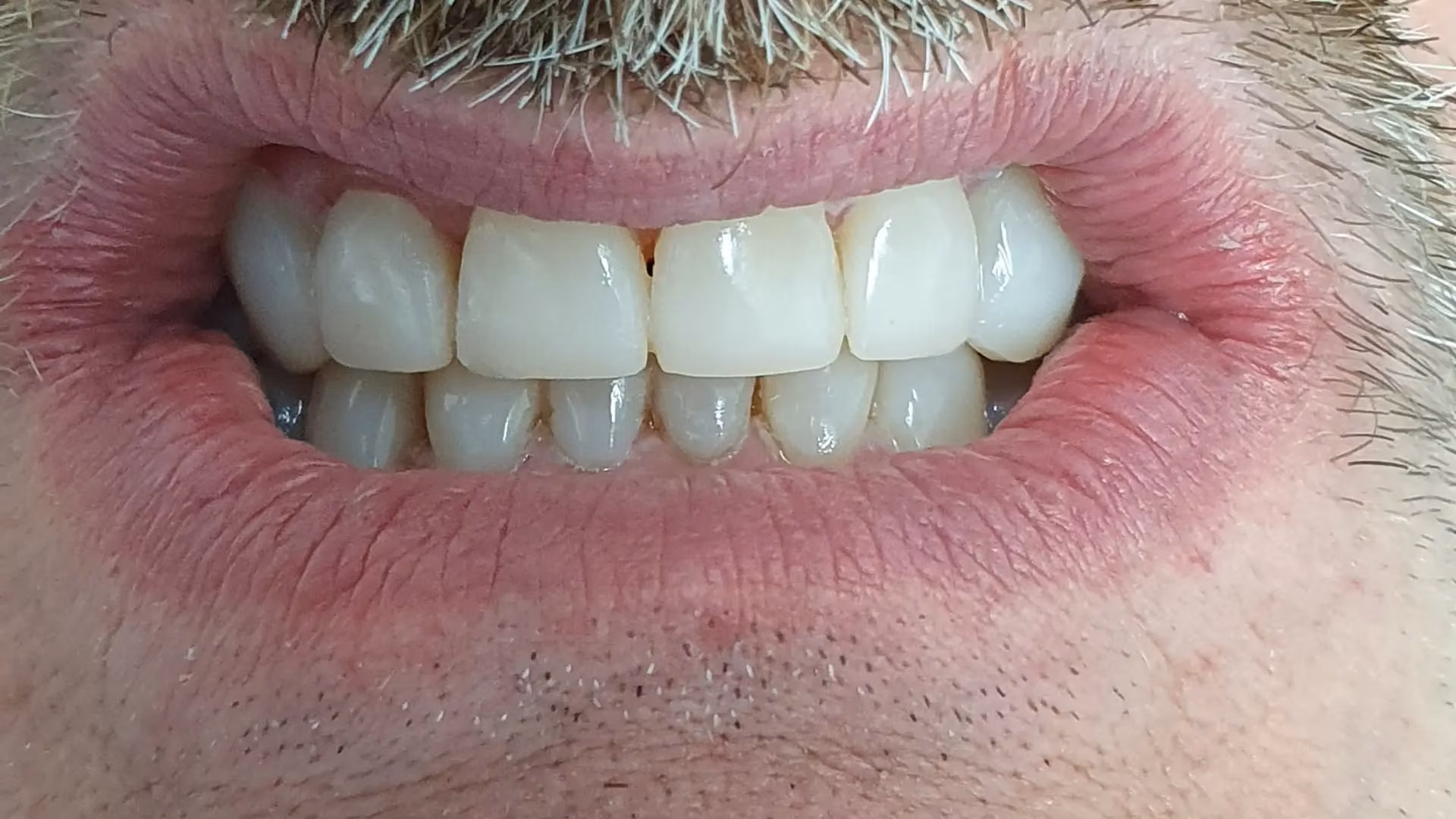 Sourire après soin 10